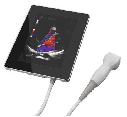 Ecógrafo Portátil Sonoscanner U-Lite