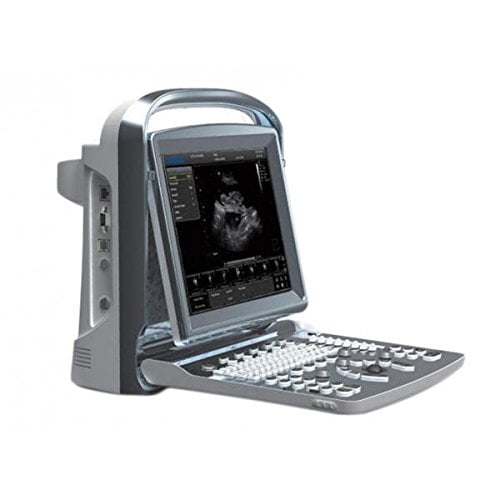 Chison eco1vet ecografo