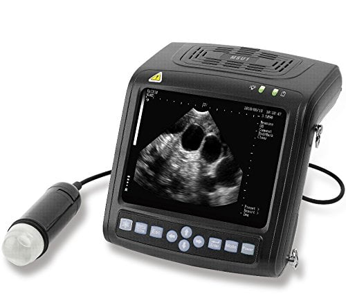 Ecógrafo MSU1 3,5 MHz